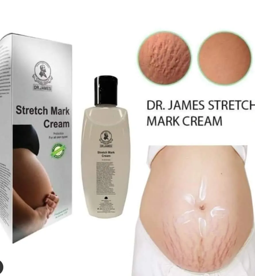 DR. James Stretch Mark Cream